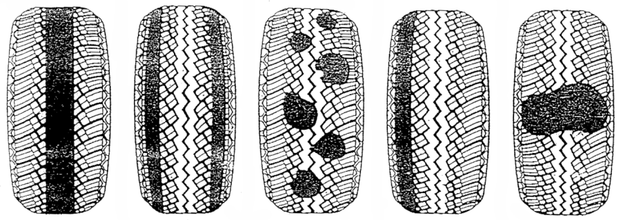 Rendellenességek, kopások